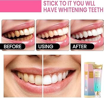 Niacinamide Whitening Toothpaste Mint Oral-max